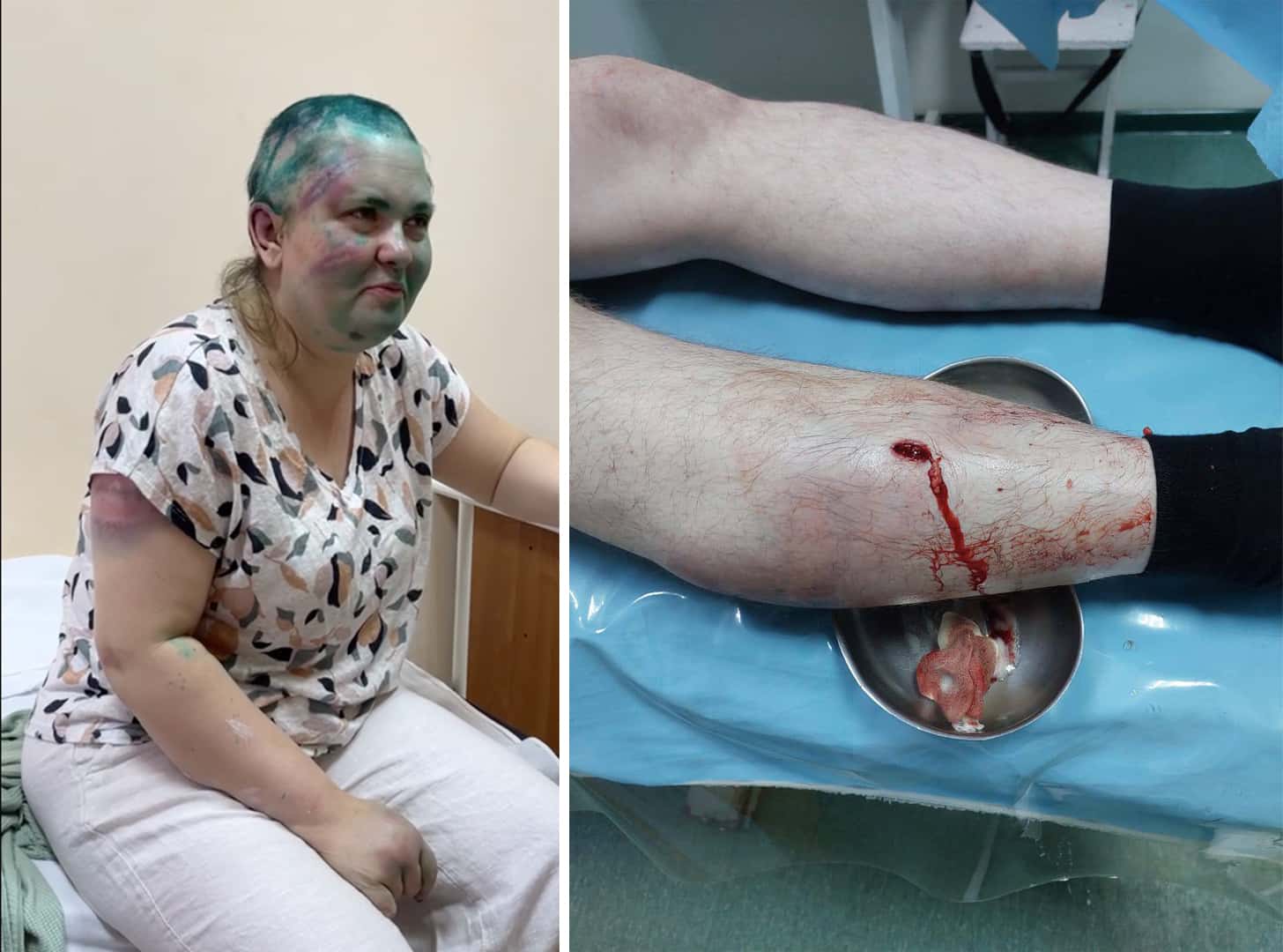 «Сделать доклад», «принять энергичные меры», «изучить ситуацию». Как власти отреагировали на избиение Милашиной и Немова